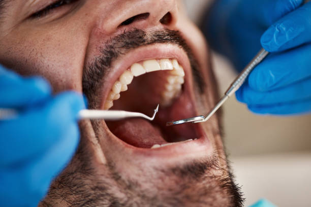 Best Emergency Root Canal Therapy in Hampton, GA